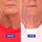 Best neck cream