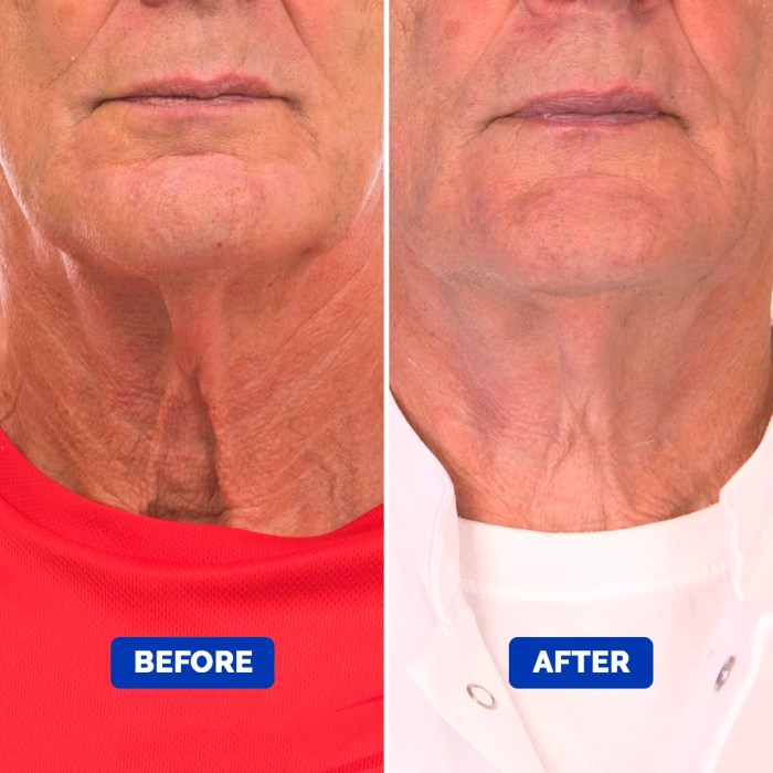 Neck cream