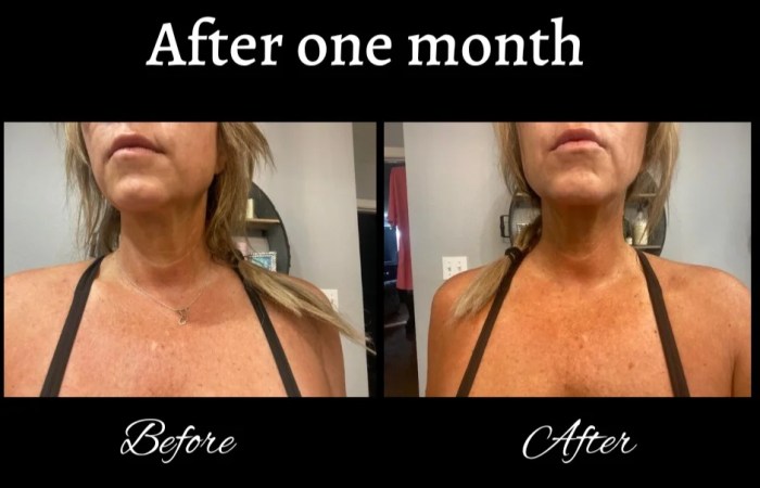 Neck cream