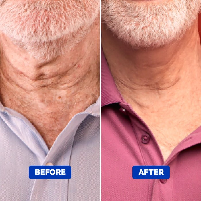 Best neck cream