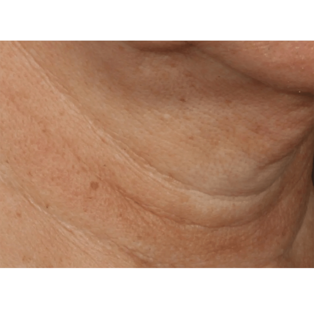 Neck cream