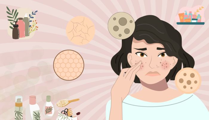 Hyperpigmentation skincare routine