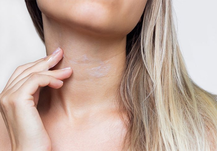 Neck cream