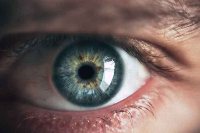 Medical Eye Free Stock Photo - Public Domain Pictures Eye cream for dark circles