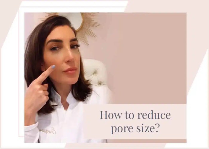Pore minimizing tips for acne