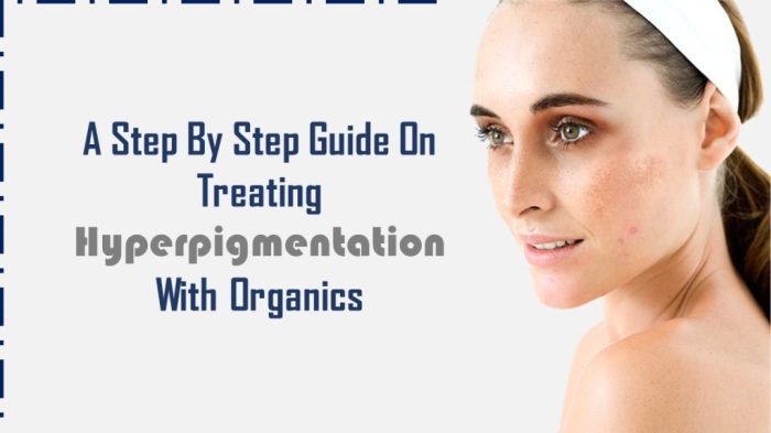 Hyperpigmentation skincare routine